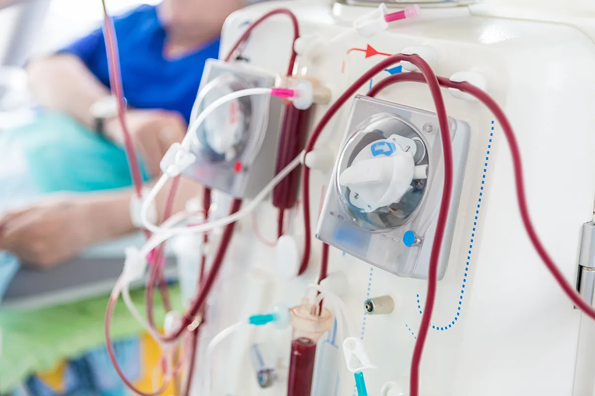 Service d'Hémodialyse et dialyse péritonéale au Centre Hospitalier de Carcassonne