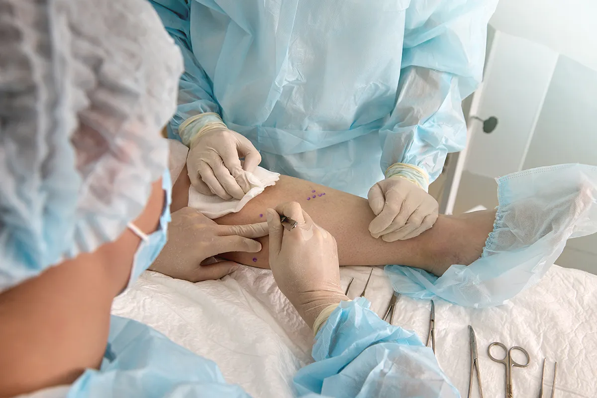 Service de chirurgie vasculaire au Centre Hospitalier de Carcassonne