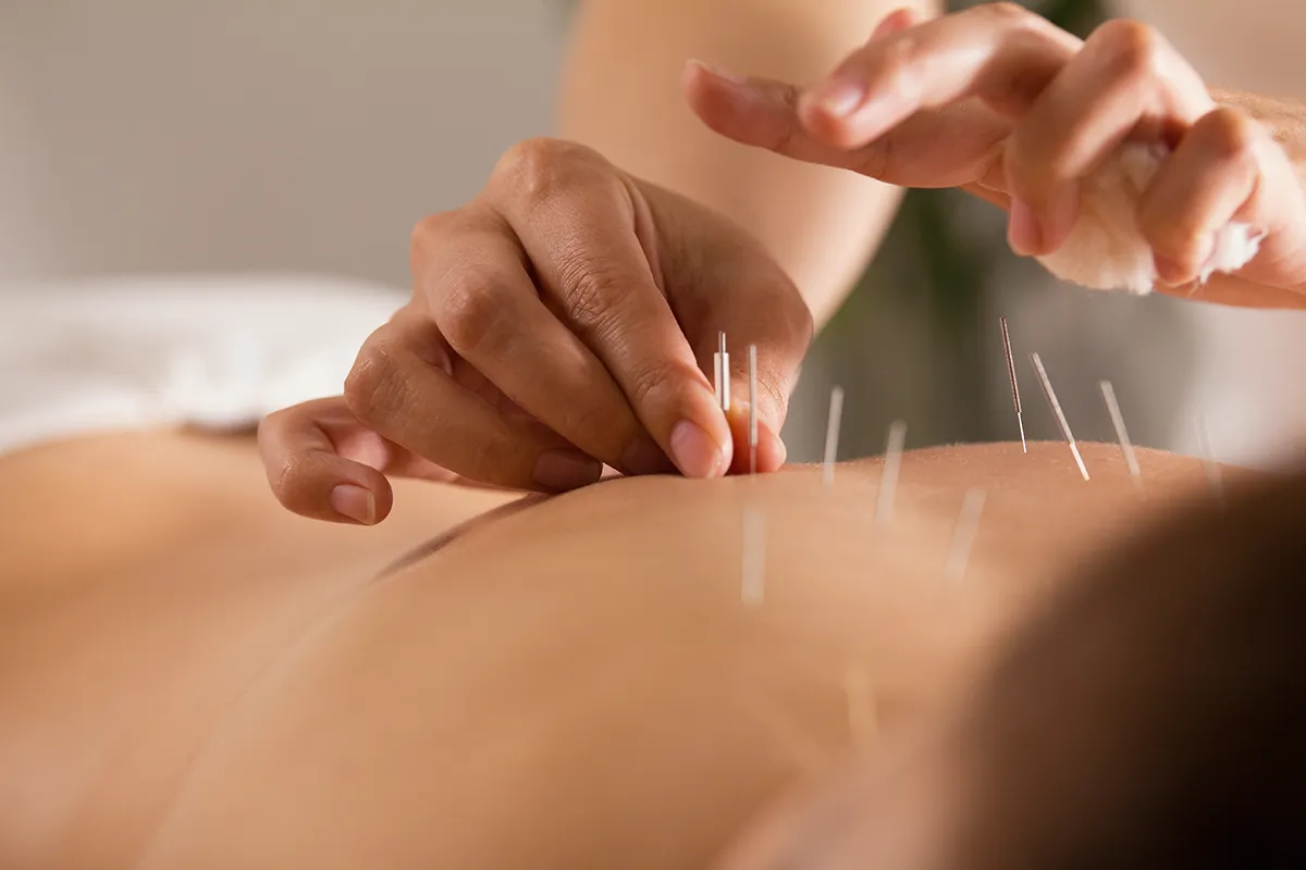 Consultation d'Acupuncture - Soins de Support d'Oncologie