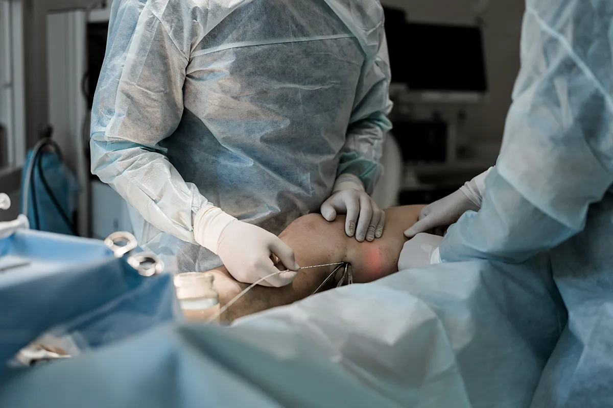 Consultation de Chirurgie Vasculaire