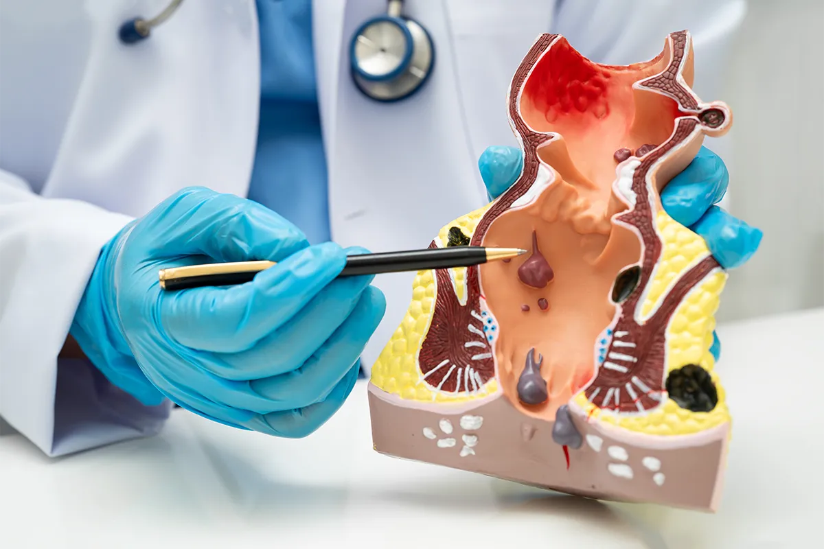 Consultation de Chirurgie Viscérale