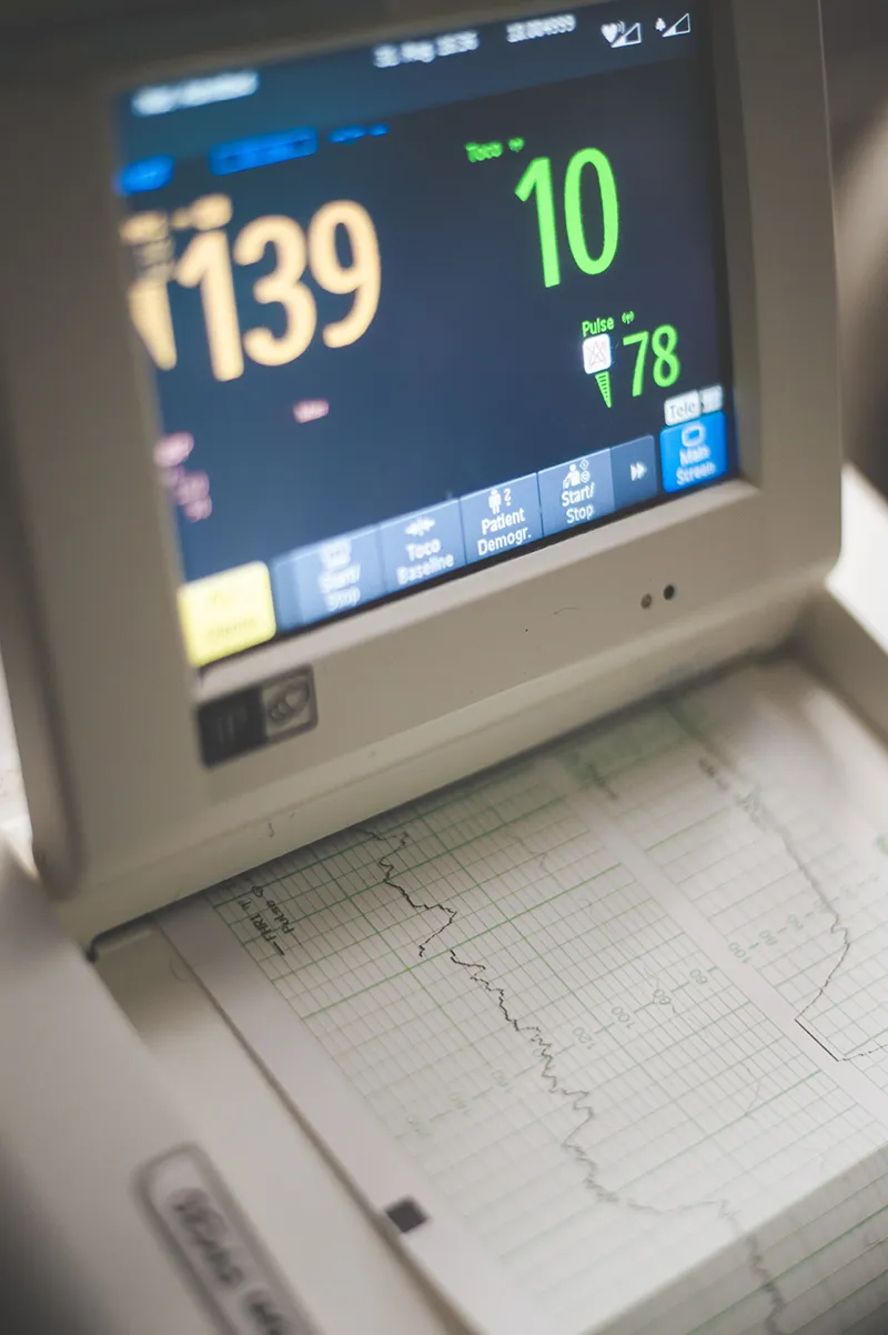 Moniteur de surveillance affichant les constantes d’un patient en milieu hospitalier.