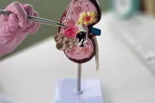 Maquette de rein - Néphrologie hémodialyse au Centre Hospitalier de Carcassonne