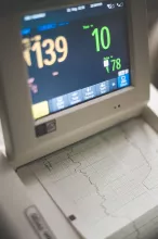 Moniteur de surveillance affichant les constantes d’un patient en milieu hospitalier.