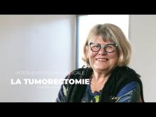 La tumorectomie - Cancertons-nous